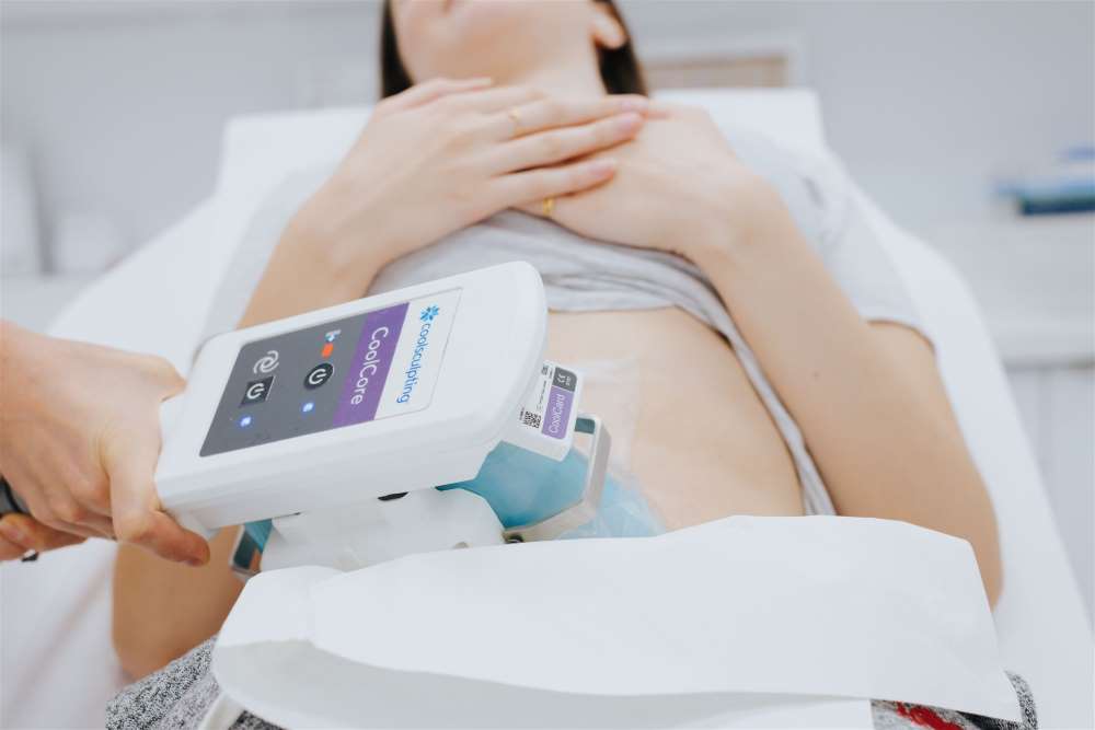 Coolsculpting tummy