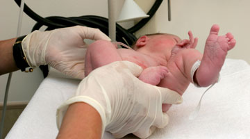 C-Sections and V-BACs - Preparing for Birth