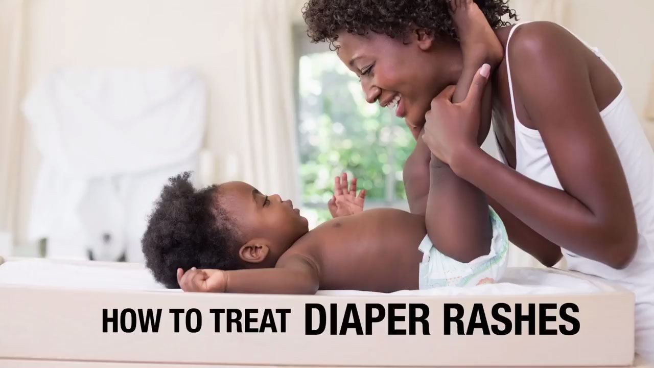 How to Treat Diaper Rashes?