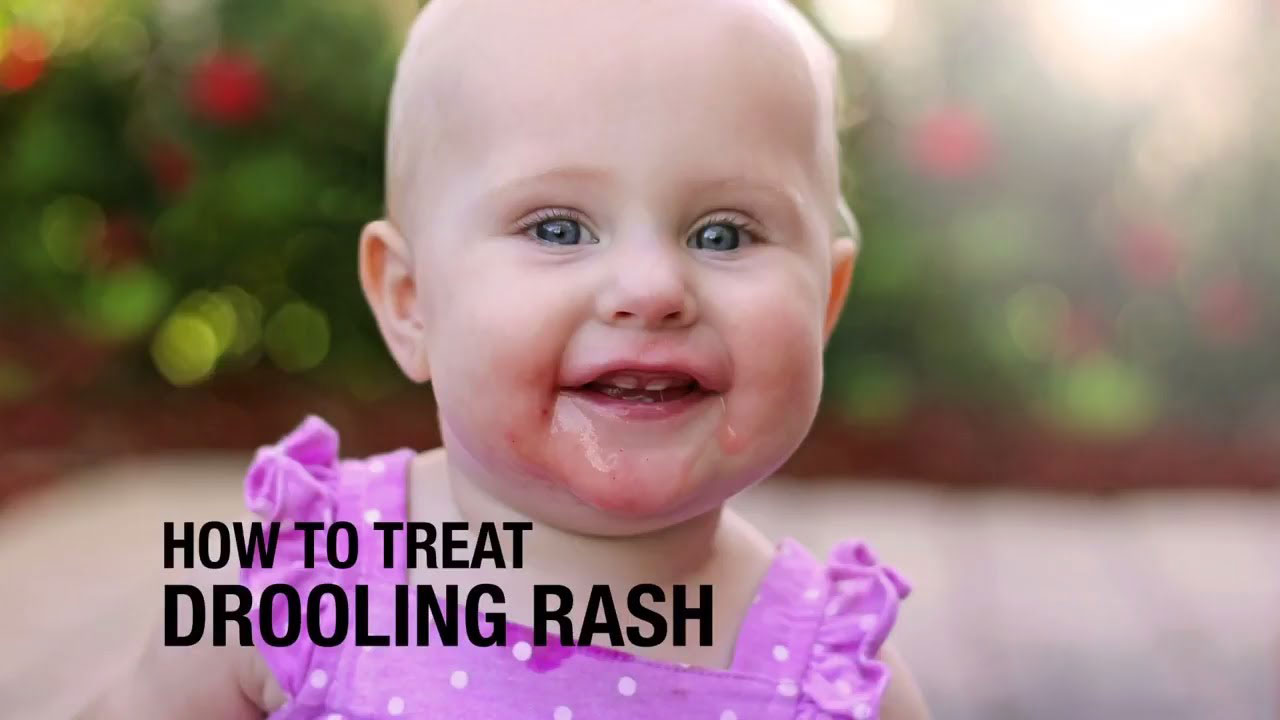 How to treat drooling rash?